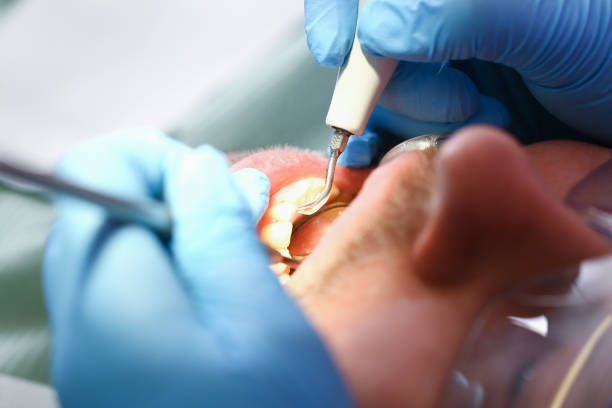 Best Emergency Treatment for Toothache in Canton, NC